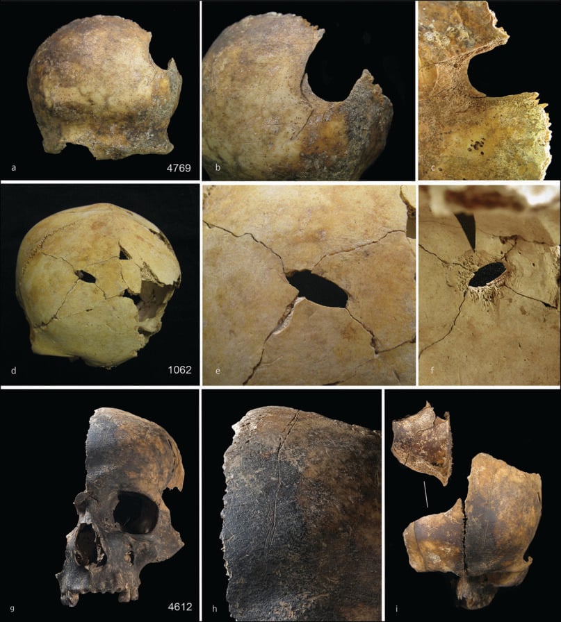 Makabryczne odkrycie w Wielkiej Brytanii: prehistoryczna masakra, kanibalizm i fragmenty ciał odnalezione przez archeologów